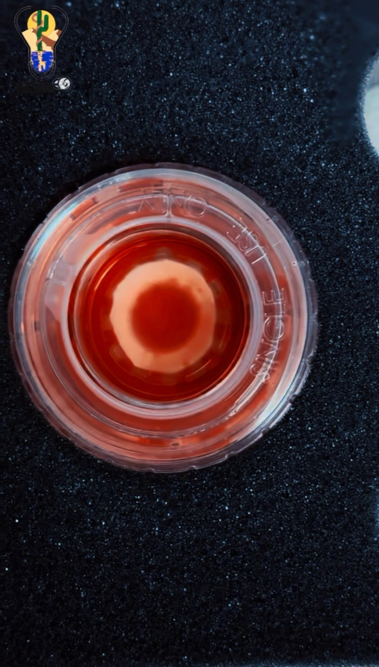 trasplantes de cornea una decada devolviendo la vista en baja california sur 3.webp